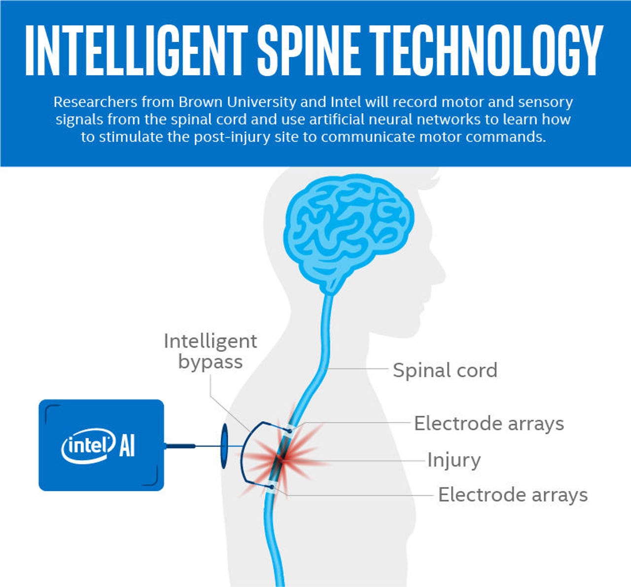 spine-intelligence-graphic-explainer-final-b-003.jpg