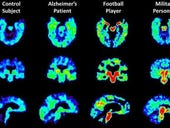 Can VR concussion education save youth football?