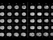 Nvidia researchers generate synthetic brain MRI images for AI research
