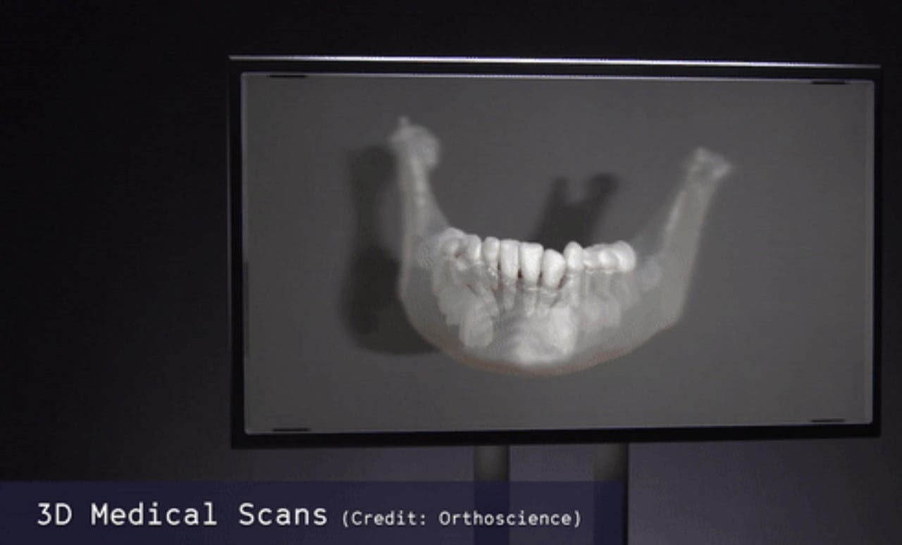 3d-medical-scan.jpg