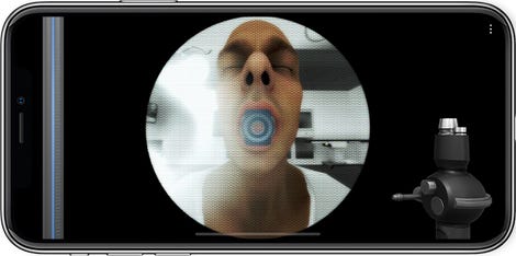 screenshot of the Level Ex game, showing a virtual rendering of a patient opening his mouth