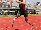 Photos: Amputee-athlete gets his C-Legs