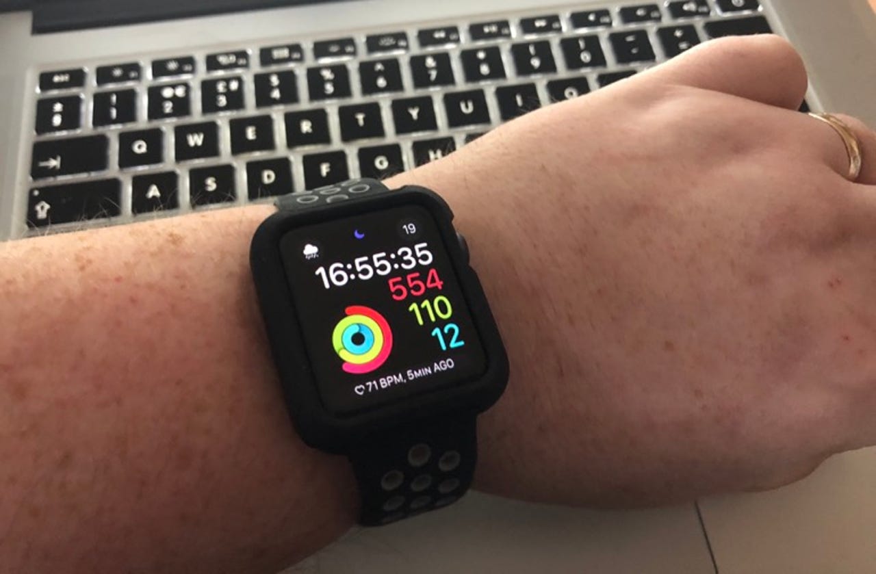 The Apple Watch 3 is awesome
