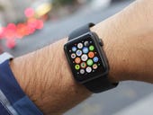 Could your Apple Watch save your life? How smartwatch sensors could help tackle a dangerous heart condition