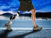 The latest in prosthetic limb technology (photos)
