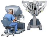 Study finds that robots are just as effective as human surgeons
