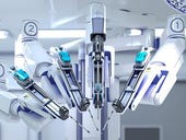Robo-assisted surgery has no clear advantage over normal ones: Researchers