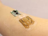 This smart bandage can help diagnose and treat your injuries