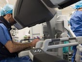 Johnson & Johnson joins robotics race, paying $5 billion for micro-surgeon