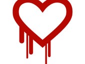 Heartbleed: Over 300,000 servers still exposed
