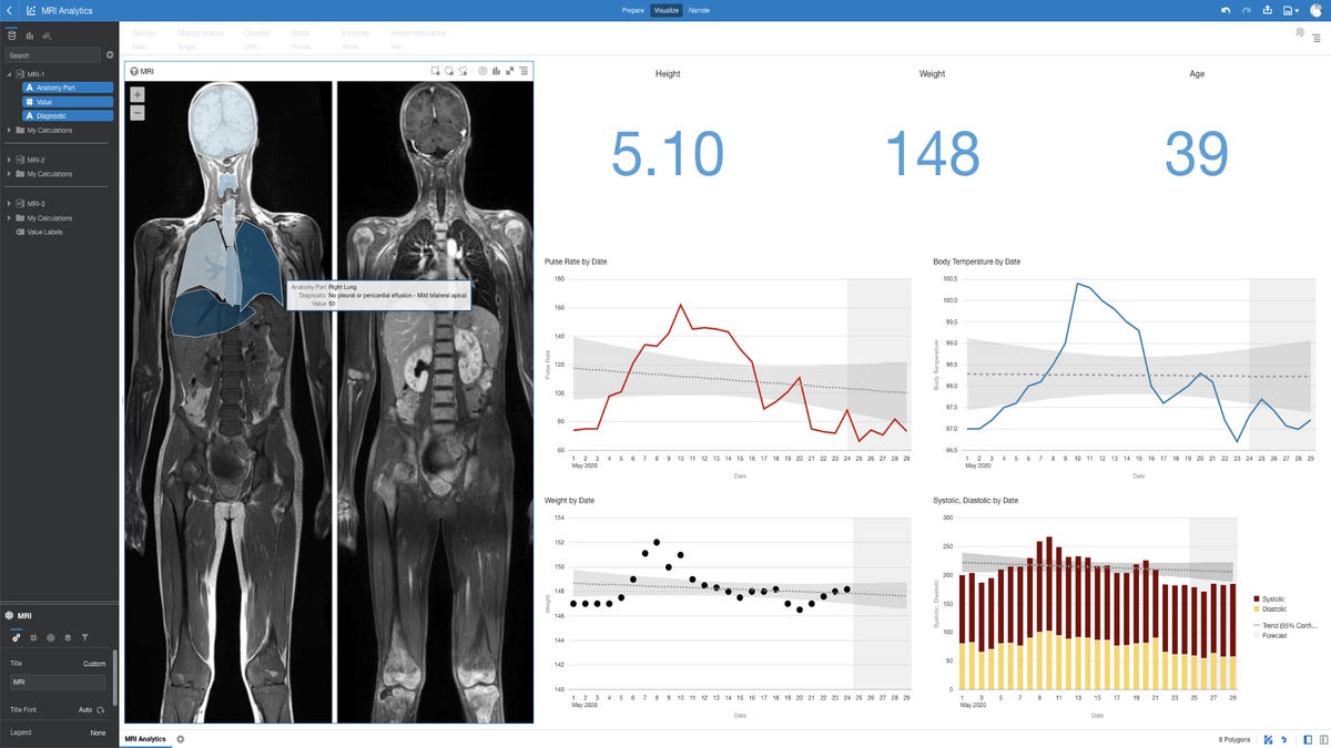 custom-map-analytics-used-in-mri-analytics-dashboard-with-human-body-map-layers-charts-and-indicators.png
