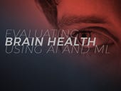 Evaluating brain health using AI and ML
