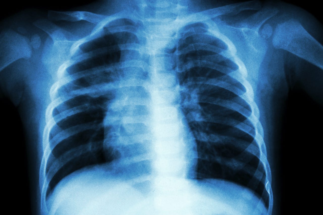 x-ray-istock.jpg