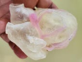 Stratasys expands 3D printed anatomical modeling efforts