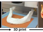 3D-printed bones? New 'hyperelastic' material could let doctors print implants on demand