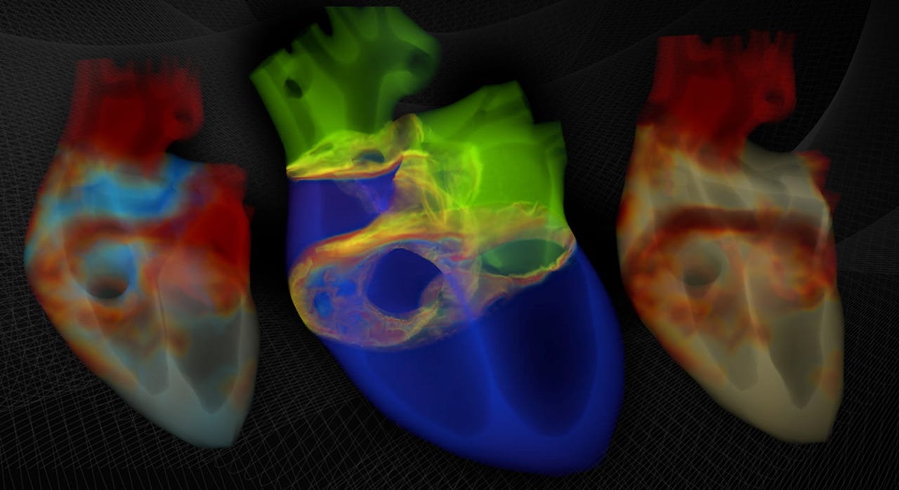 nvidia-barcelona-supercomputing-center-heart-simulation.jpg