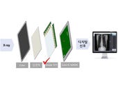 LG Display develops new film transistor for digital X-ray detectors