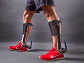Knee pain? Achy joints? Passive bionic devices are coming