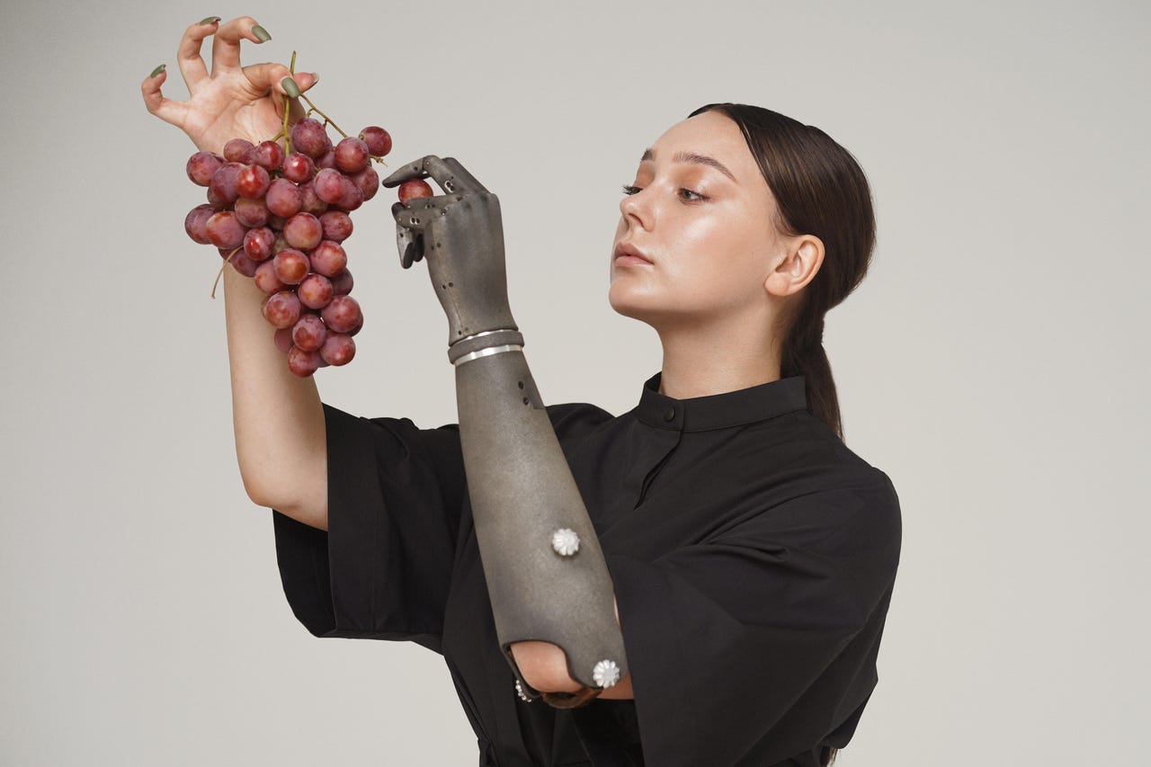 A woman holds grapes in one hand and tries to grab grape with her other prosthetic hand