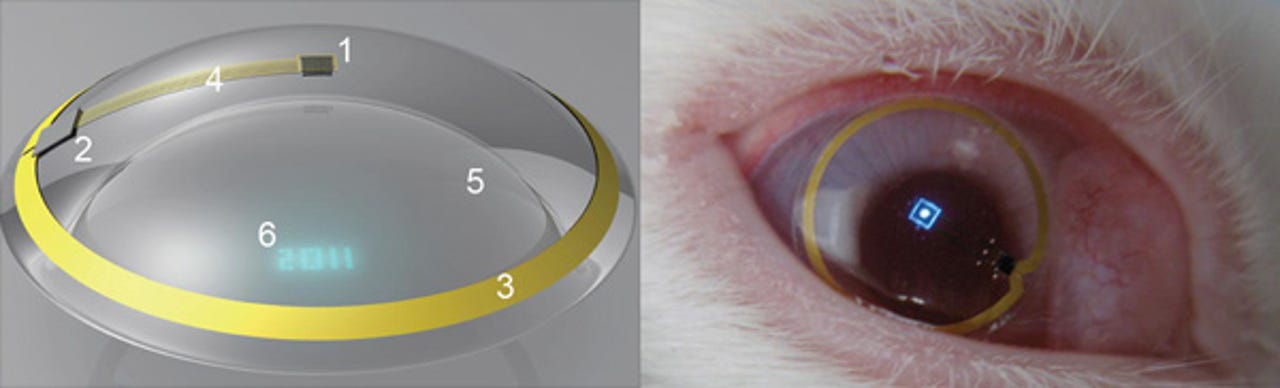 Successful test for electronic contact lens