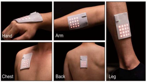 Flexible patches with buttons on a human arm, leg and back