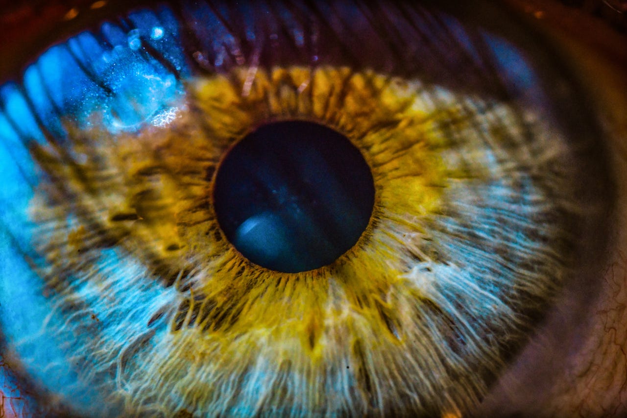 eye-iris