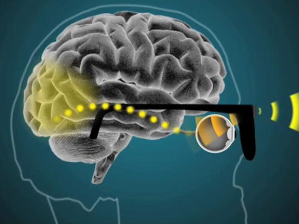 Australian researchers develop prototype bionic eye, implants by 2013 | ZDNET