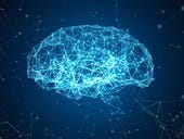 IBM and Michael J. Fox Foundation develop machine learning model for Parkinson’s