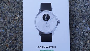 scanwatch-1.jpg