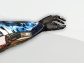 Thought-controlled bionic arms now available off-the-shelf
