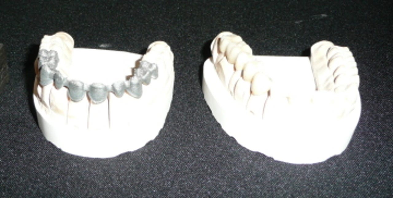 40152896-3-teeth.jpg